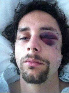 盘点足坛那些打架暴怒的时刻,足坛十大斗殴狠人