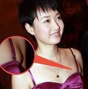 怎样减腋下赘肉,教你甩掉烦人赘肉