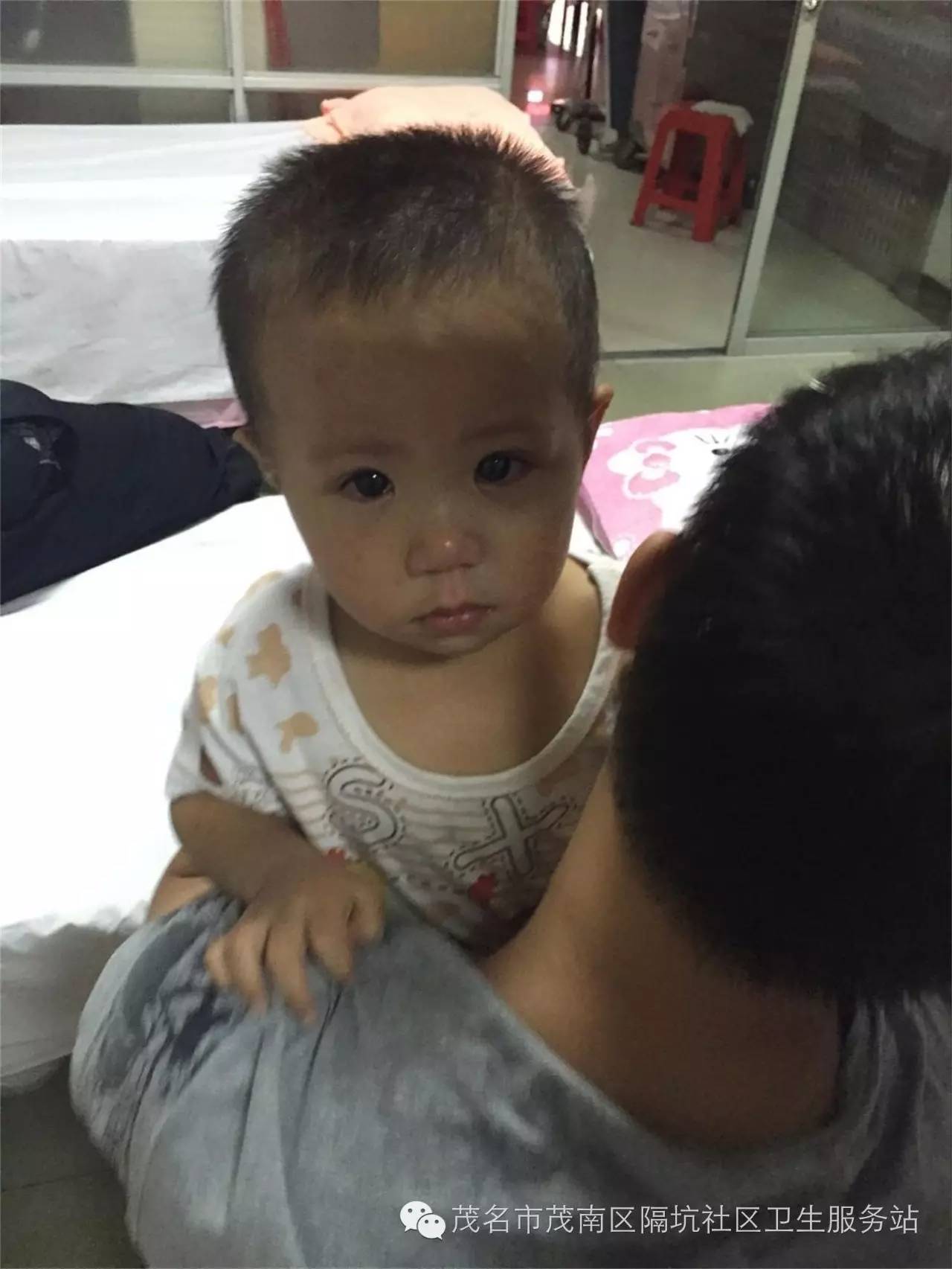 宝宝面瘫有治愈的可能吗,宝宝面瘫