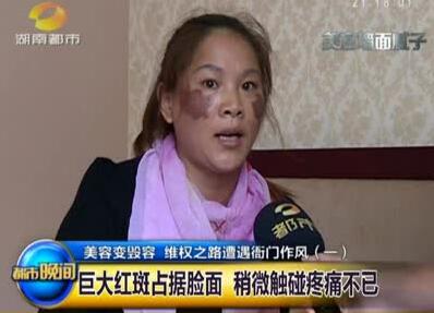 去角质了护肤品还是不吸收,去角质后皮肤过敏怎么解决