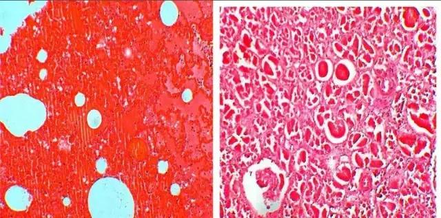 中暑会不会出人命,中暑严重会出人命吗