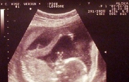 36岁为丈夫做试管婴儿,广东30岁做试管婴儿