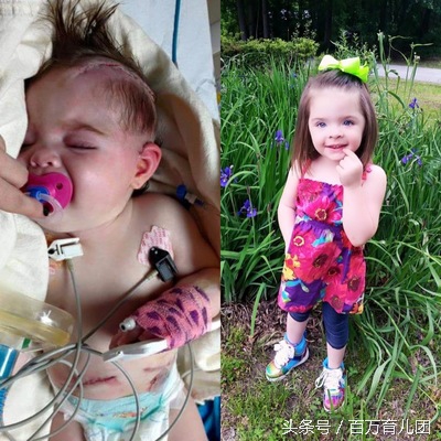 吃完糖丸疫苗呕吐怎么缓解,吃了糖丸疫苗宝宝不喝奶