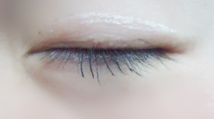 双眼皮最快做法,如何快速的自然形成双眼皮