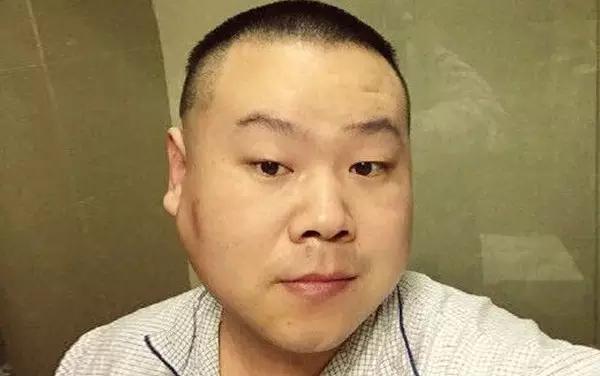 被春晚吉祥物丑哭了，那谜一样的「耳下两坨」难道不是腮腺肿物？