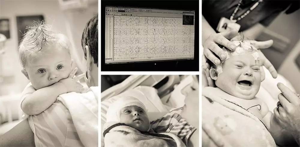 小孩患唐氏综合征,唐氏综合征比较幸运的孩子