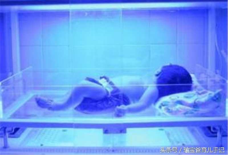 宝宝黄疸妈妈不能吃黄色的东西吗,新生儿黄疸蓝光干预表