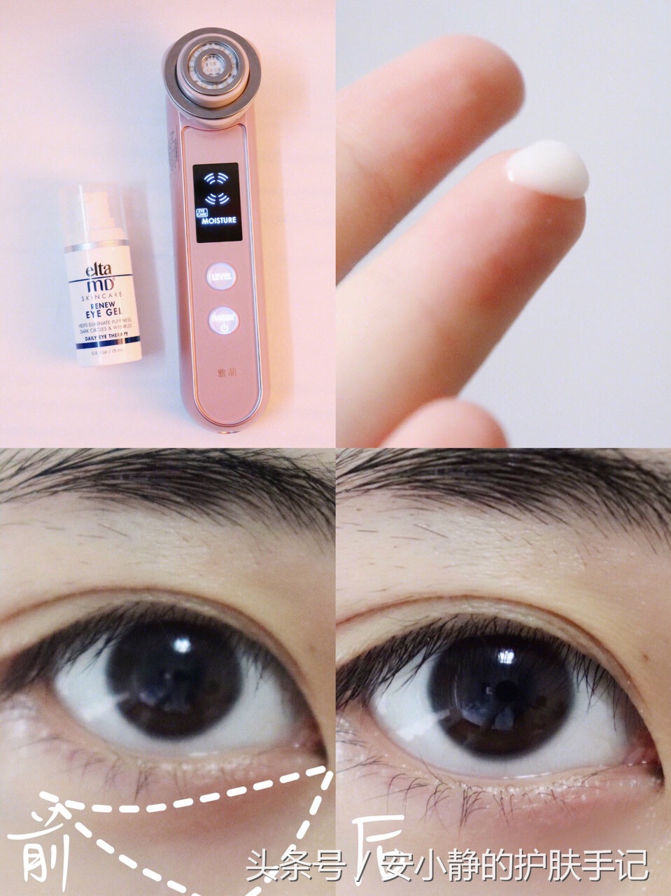 换季皮肤长痘起皮干燥怎么办,换季皮肤敏感爆痘怎么办