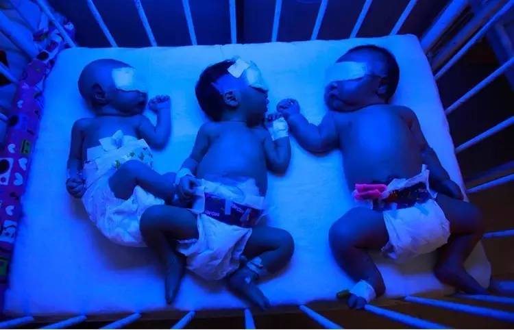 退黄疸药茵栀黄的图片,茵栀黄还有其他退黄药吗