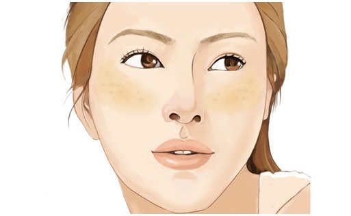 航天健康大讲堂--*褐斑黄**，想说再见不容易