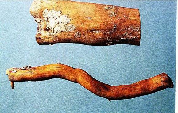 有效的失眠秘方，用了这个再也不会失眠了！