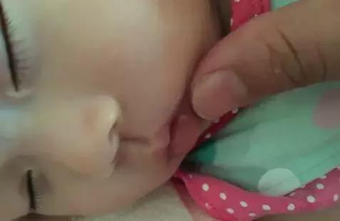 宝宝总患口腔溃疡怎么办,宝宝经常有口腔溃疡