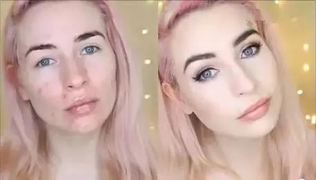 有闭口痘痘化的妆,脸上有粉刺痘痘怎么化底妆