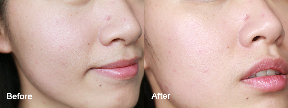 春纪黑米清肌面膜怎么用,春纪冻干面膜使用方法