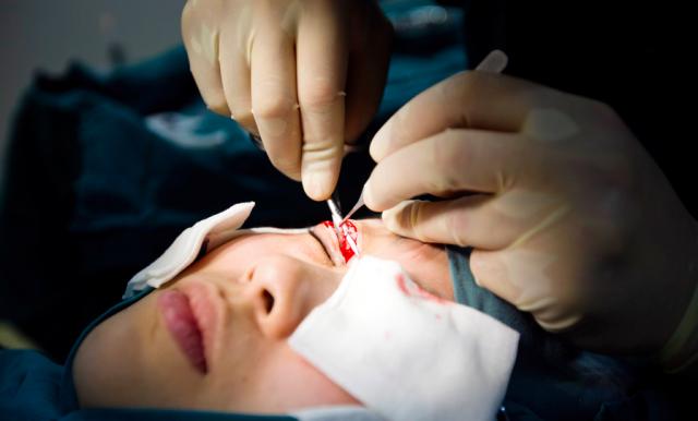 为什么大家都喜欢大眼睛双眼皮,为什么大家喜欢做双眼皮手术