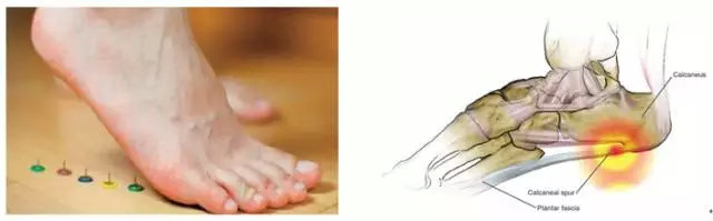 大夫不建议做造影,做ct检查是否就不用做超声检查