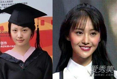 整容后遗症眼眨嘴歪,整容后遗症脸歪鼻子歪