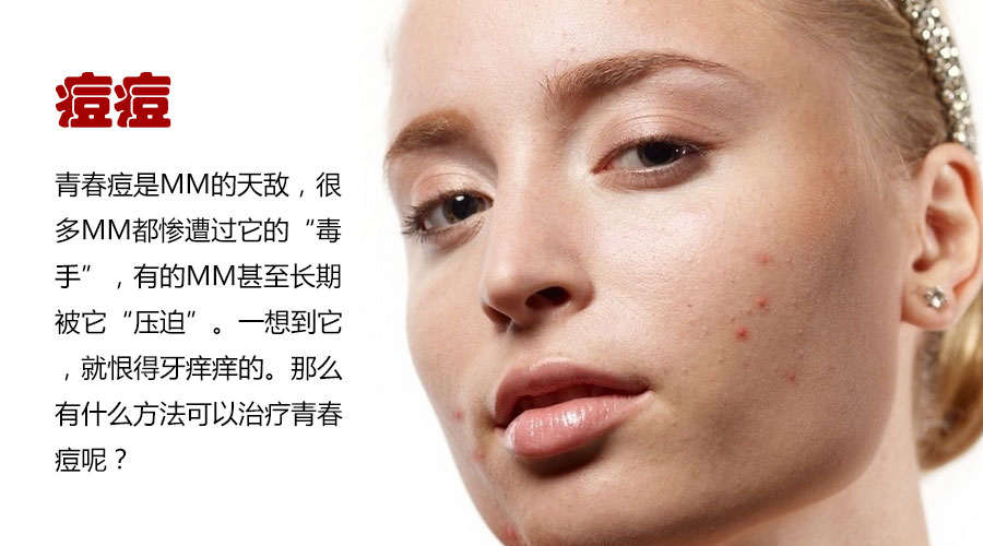 怎么才能治好痘痘肌,痘痘肌修复逆袭
