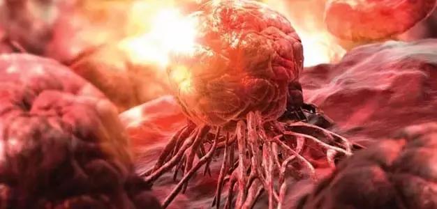 攻克癌症的设备,攻克癌症的绝技