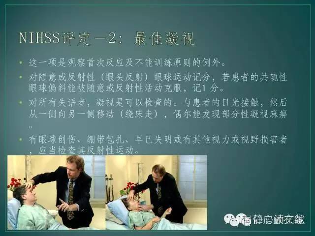 nihss评分2,nihss简单评分