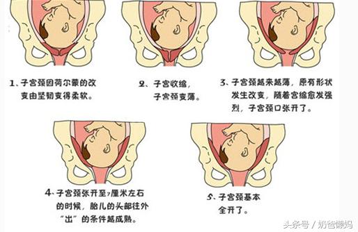 女人生孩子开几指才能顺产,生孩子骨缝开几指能生