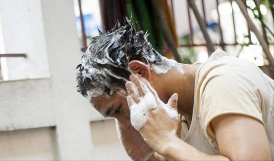 头皮屑多到底怎么回事,女人头皮屑多怎么回事