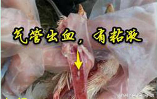 支气管痰多堵塞的症状和危害,支气管堵塞能做手术是微创吗