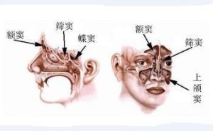 早上洗头会引起头痛吗,早上头痛头晕是什么原因