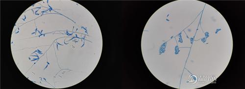 温医大的医学检验技术怎么样,温医大医学检验