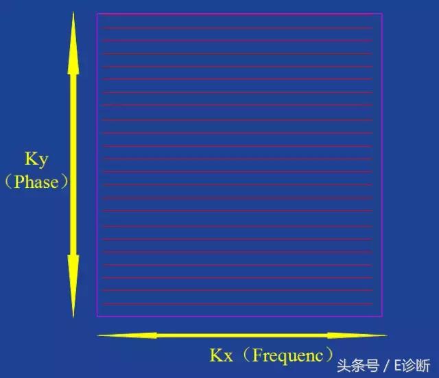 磁共振伪影及解决方案,e系列诊断