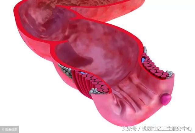 肛周褶皱凸出软软的不是痔疮,体检如何断定你有没有痔疮