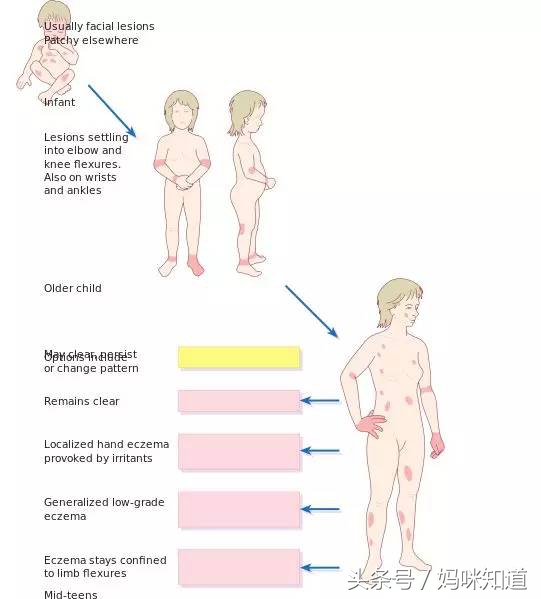 春暖花开要预防过敏性皮肤疾病,春暖花开一定要小心四种虫