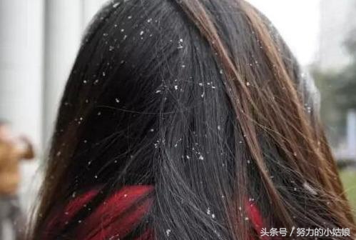 头上为什么会有螨虫?阿婆用一勺盐祛螨,千万螨虫落荒而逃