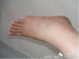 从脚看健康程度图解,从脚指甲颜色看身体健康