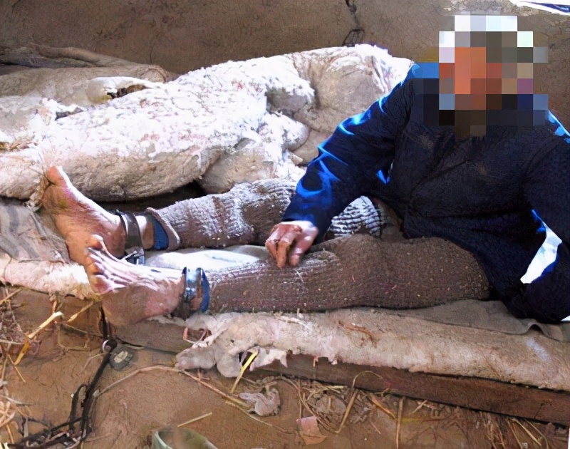 孤僻懒散症,阴性孤僻症怎么治愈