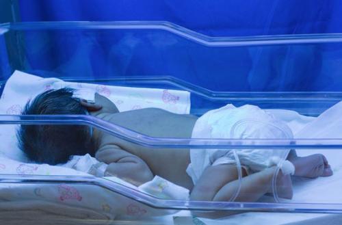 新生儿溶血性黄疸住院几天能好,新生儿abo溶血性黄疸出院后反复