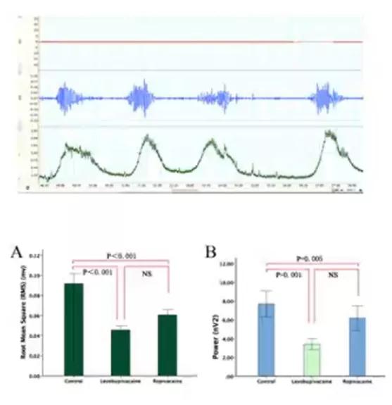 宋兴荣麻醉治疗自闭,宋兴荣麻醉治疗