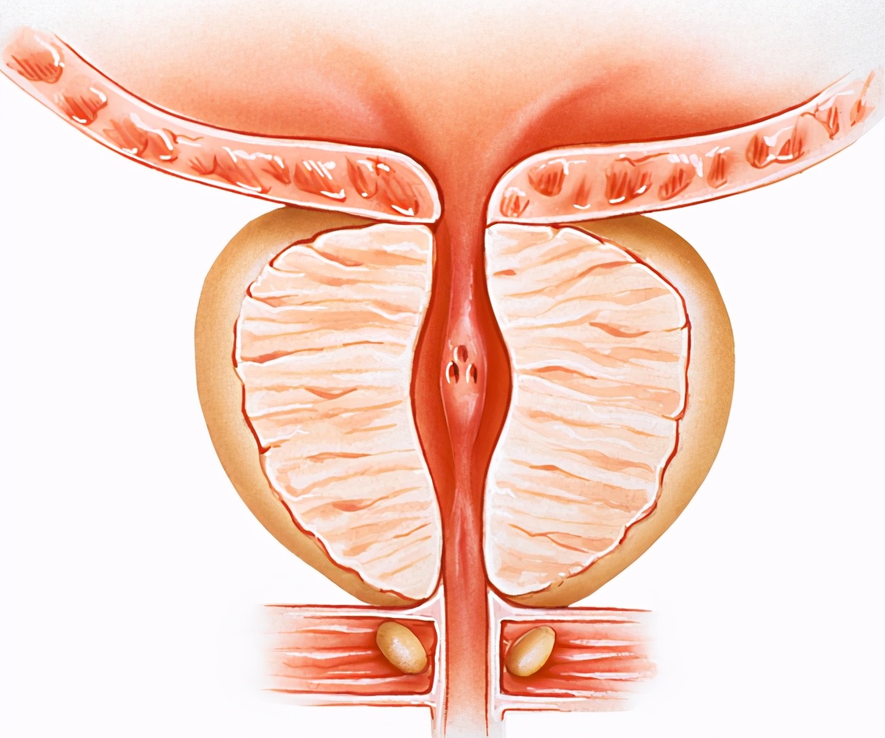 治疗前列腺增生的药物最佳组合,治疗前列腺增生的十大中药