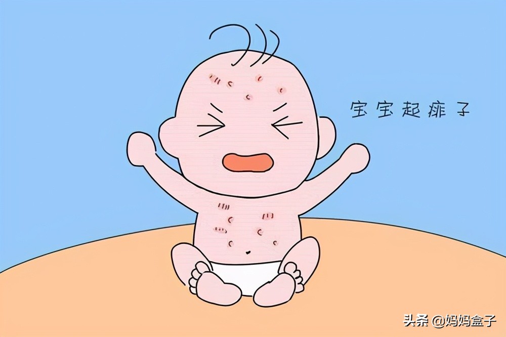 宝宝热痱最快解决的方法,夏天宝宝怎么预防热疹