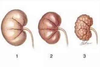 比香烟更容易致癌的食物有哪些 (比香烟致癌的食物)
