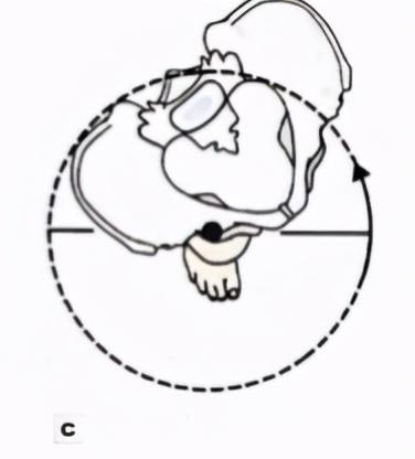 走着走着低头一看,裤子裙子跑偏了?来认领一下是否骨盆旋转