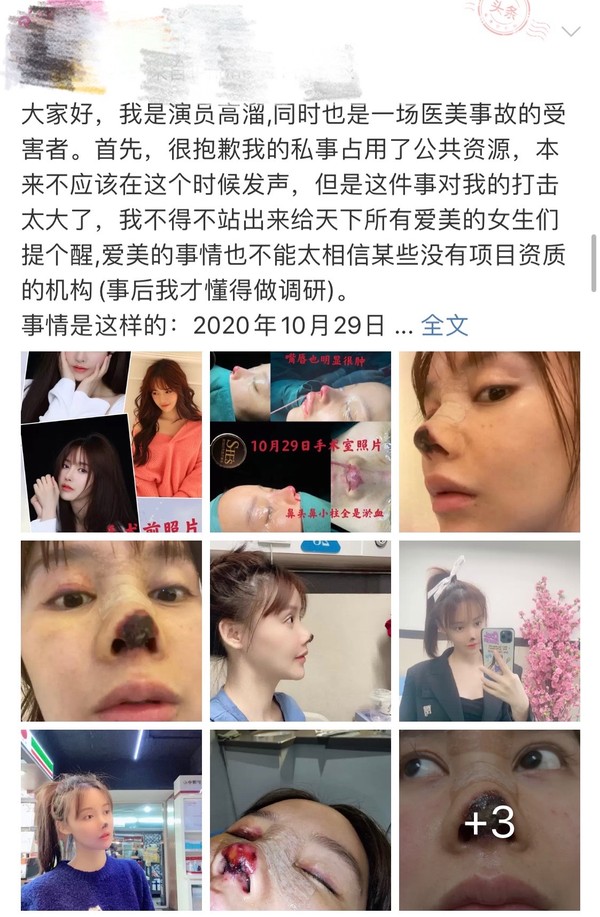 女星高溜整容,演员高溜整容失败欲轻生