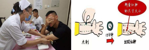 皮肤过敏痒在家怎么处理,皮肤瘙痒过敏原化验能查出病因吗