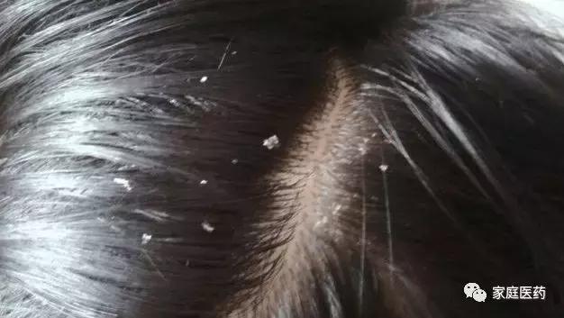 热姜水和生姜水的作用及功效,热生姜的功效和作用