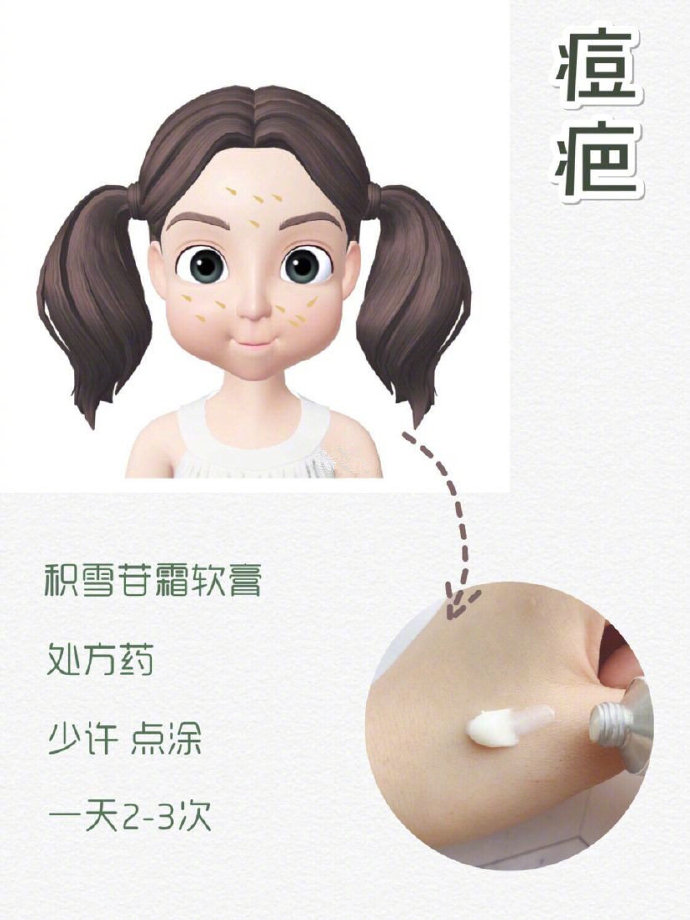 去除黑头痘印痘坑痘疤的最好产品,痘坑痘印暗红色修复的最佳方法