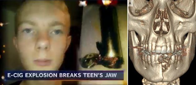 你觉得*子烟电**很酷，*子烟电**公司却把你当白老鼠