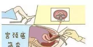 周口豫东医院妇科医生友情提醒：别让妇科疾病伤害了你