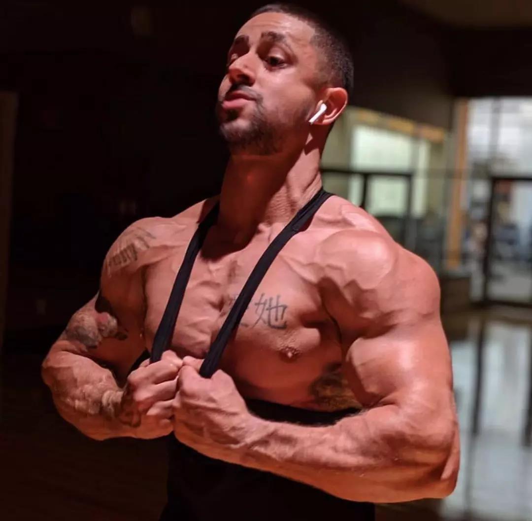 健身后肌肉上有红色纹路,健身后有条纹怎么回事