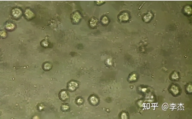 细胞培养出现链球菌污染怎么办,细胞培养如何应对支原体污染