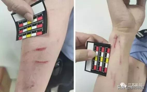 璀︽柟鍥炲簲琚墦姘戣,110鎶ヨ璀﹀療鍙互鍦ㄧ幇鍦烘妸浜烘姄浜嗗悧